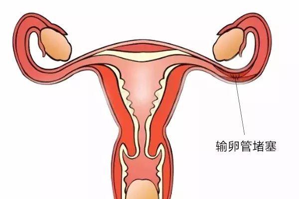 通草的功效与作用能通输卵管堵塞,最新答案解释落实_扩展版6.986